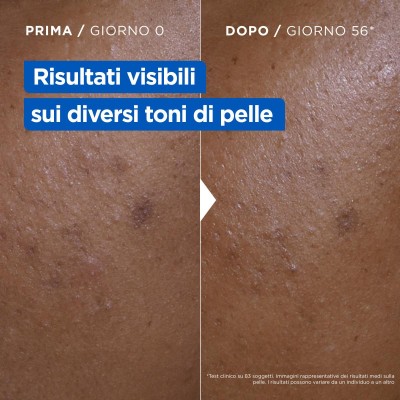 1 - Mixa Niacinamide Bright Crema Idratante Anti-Macchie per Pelle Secca e Spenta 400 ml
