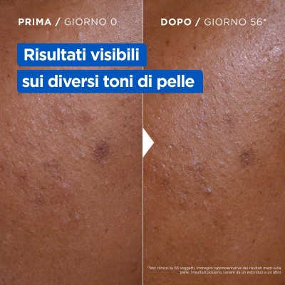 1 - Mixa Niacinamide Bright Lozione Corpo per Pelle Secca e Spenta 250 ml