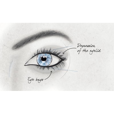 1 - Lancôme Advanced Génifique Yeux Light-Pearl siero per occhi 20 ml WOMEN FACE
