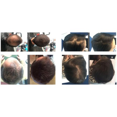 1 - Tricomix Keratin Fibers Grey 12g