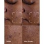 2 - Even Better Advanced Cinical Dark Spot Clearing Serum