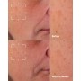 3 - Even Better Advanced Cinical Dark Spot Clearing Serum