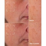 3 - Even Better Advanced Cinical Dark Spot Clearing Serum