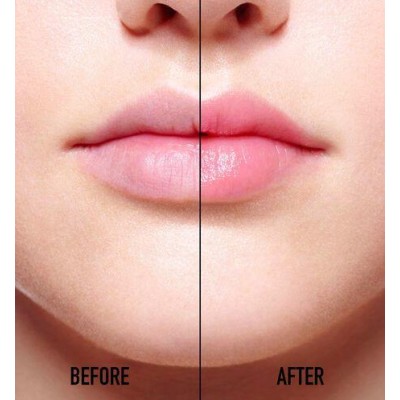 2 - Dior Addict Lip Glow 001 Pink 3.5g