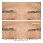 4 - Dior Capture Totale Hyalushot 15ml